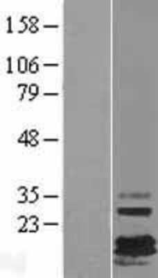 Western Blot: FXYD7 Overexpression Lysate [NBL1-10882]