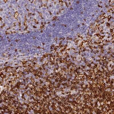 Immunohistochemistry-Paraffin: FYB/ADAP/SLAP130 Antibody [NBP1-91916]