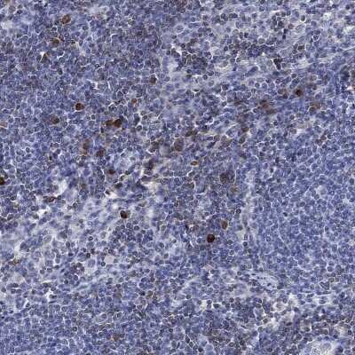 Immunohistochemistry-Paraffin: FYB/ADAP/SLAP130 Antibody [NBP3-16998]