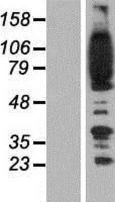 Western Blot: FYB/ADAP/SLAP130 Overexpression Lysate [NBP2-08205]