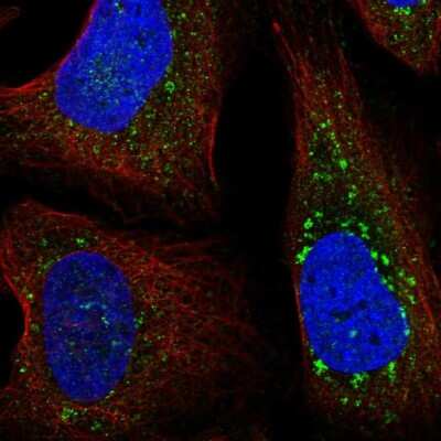 Immunocytochemistry/ Immunofluorescence: FYCO1 Antibody [NBP2-58241]