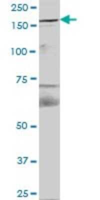 Western Blot: FYCO1 Antibody [H00079443-B01P]