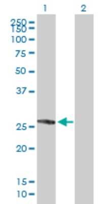 Western Blot: FYCO1 Antibody [H00079443-B01P]