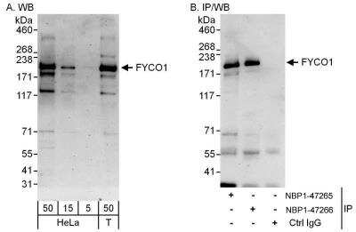 Western Blot: FYCO1 Antibody [NBP1-47265]