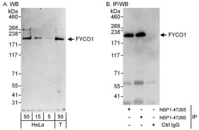 Western Blot: FYCO1 Antibody [NBP1-47266]