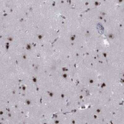 Immunohistochemistry-Paraffin: FYTTD1 Antibody [NBP3-17370]