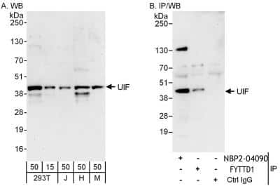 Immunoprecipitation: FYTTD1 Antibody [NBP2-04090]