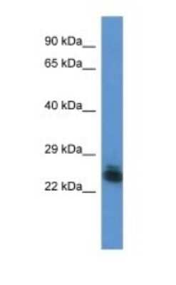 Western Blot: FYTTD1 Antibody [NBP1-74256]