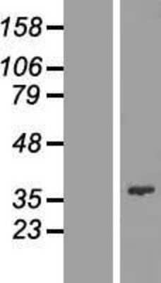 Western Blot: FYTTD1 Overexpression Lysate [NBL1-10888]