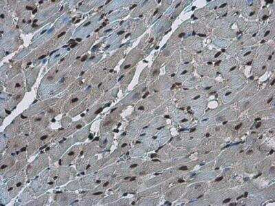 Immunohistochemistry-Paraffin: FZR1/CDH1 Antibody [NBP2-15840]