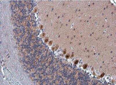 Immunohistochemistry-Paraffin: FZR1/CDH1 Antibody [NBP2-15840]