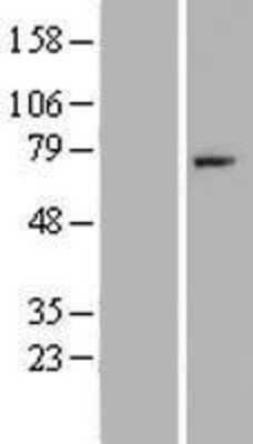 Western Blot: Complement Factor I Overexpression Lysate [NBP2-11153]