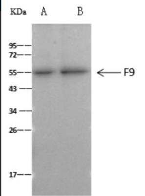 Immunoprecipitation: Factor IX Antibody (034) [NBP2-89906]