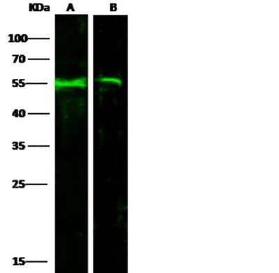 Western Blot: Factor IX Antibody (034) [NBP2-89906]