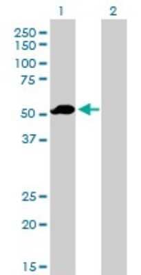 Western Blot: Factor IX Antibody (2C9) [H00002158-M01]