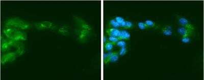 Immunocytochemistry/ Immunofluorescence: Factor IX Antibody [NBP1-33581]