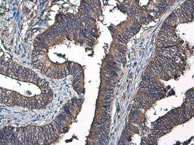 Immunohistochemistry-Paraffin: Factor IX Antibody [NBP1-33581]