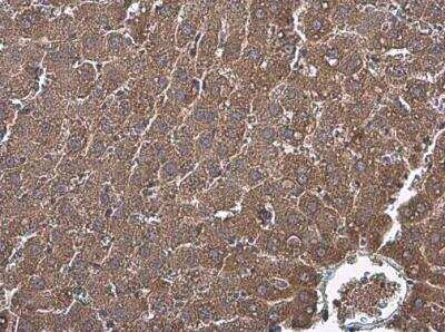 Immunohistochemistry-Paraffin: Factor IX Antibody [NBP1-33581]
