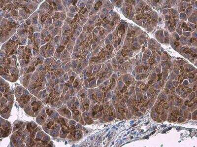 Immunohistochemistry-Paraffin: Factor IX Antibody [NBP1-33581]
