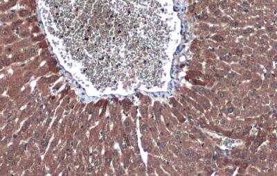 Immunohistochemistry-Paraffin: Factor IX Antibody [NBP1-33581]