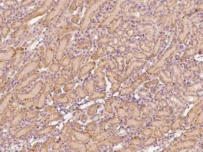 Immunohistochemistry-Paraffin: Factor IX Antibody [NBP2-98270]