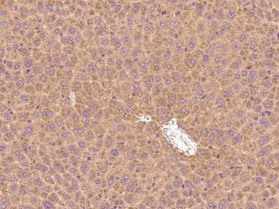 Immunohistochemistry-Paraffin: Factor IX Antibody [NBP2-98270]