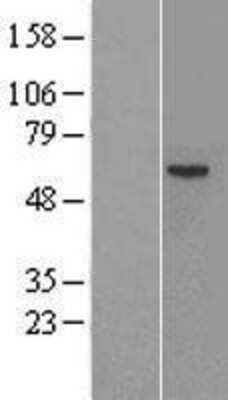 Western Blot: Factor IX Overexpression Lysate [NBL1-10414]