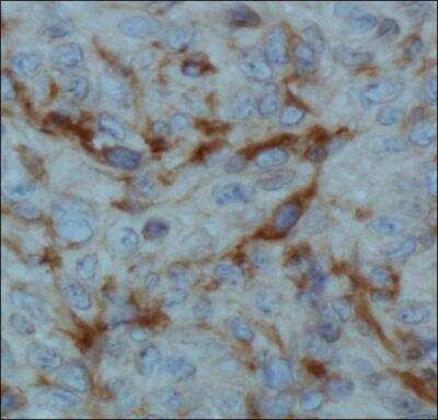 Immunohistochemistry: FIH-1/HIF-1AN Antibody (162c) [NBP1-30333]
