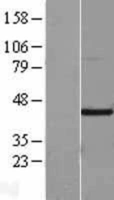 Western Blot: FIH-1/HIF-1AN Overexpression Lysate [NBL1-11541]