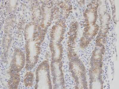 Immunohistochemistry-Paraffin: Coagulation Factor VII Antibody [NBP1-31421]