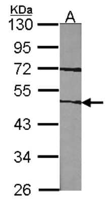 Western Blot: Coagulation Factor VII Antibody [NBP1-31421]
