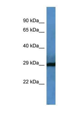 Western Blot: Coagulation Factor VII Antibody [NBP1-68896]