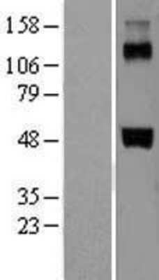 Western Blot: Coagulation Factor VII Overexpression Lysate [NBL1-10412]