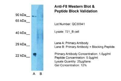 Western Blot: Factor VIII Antibody [NBP1-68934]