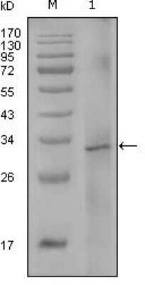 Western Blot: Factor VIII Antibody (5E9B2)BSA Free [NBP1-51555]