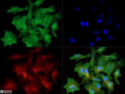 Immunocytochemistry/ Immunofluorescence: Factor VIII Antibody - BSA Free [NB100-91761]