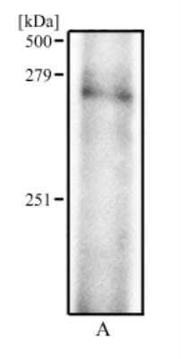 Western Blot: Factor VIII AntibodyBSA Free [NB100-91761]