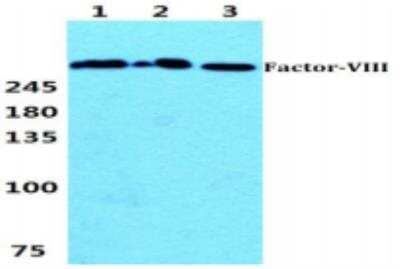 Western Blot: Factor VIII AntibodyBSA Free [NB100-91761]