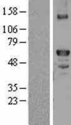 Western Blot: Coagulation Factor X Overexpression Lysate [NBL1-10402]