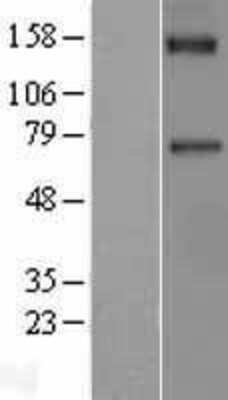 Western Blot: Coagulation Factor XI Overexpression Lysate [NBL1-10403]