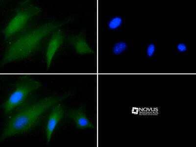 Immunocytochemistry/ Immunofluorescence: Factor XII Antibody [NBP1-94203]
