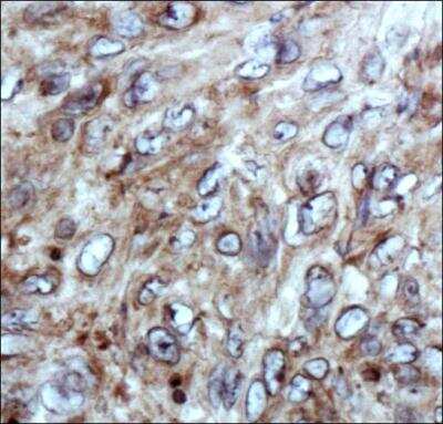 Immunohistochemistry: Factor XII Antibody [NBP1-94203]
