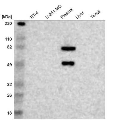 Western Blot: Factor XII Antibody [NBP1-86518]