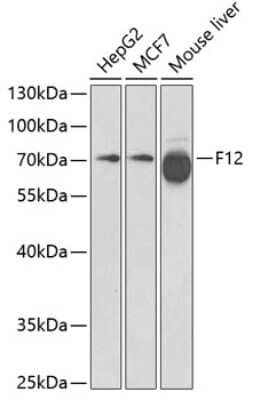 Western Blot: Factor XII AntibodyBSA Free [NBP3-03683]