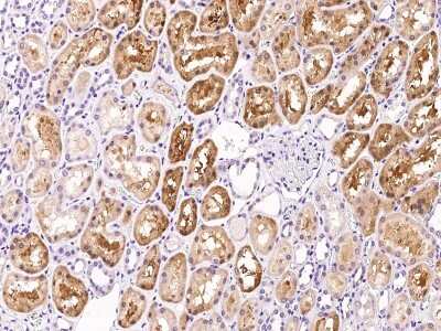 Immunohistochemistry-Paraffin: Factor XII heavy chain Antibody [NBP2-99473]