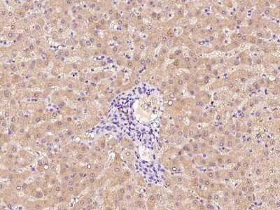 Immunohistochemistry-Paraffin: Factor XII heavy chain Antibody [NBP2-99473]