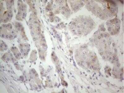 Immunohistochemistry: Factor XII heavy chain Antibody (OTI1H5) - Azide and BSA Free [NBP2-70695]