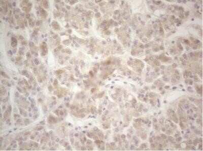 Immunohistochemistry: Factor XII heavy chain Antibody (OTI1H5) - Azide and BSA Free [NBP2-70695]