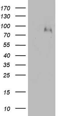 Western Blot: Factor XIIIb Antibody (OTI1A3) [NBP2-45563]