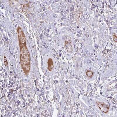 Immunohistochemistry: Factor XIIIb Antibody [NBP2-38662]